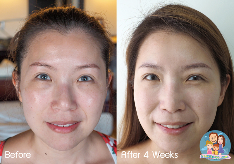 pond age miracle wrinkle corrector pantip