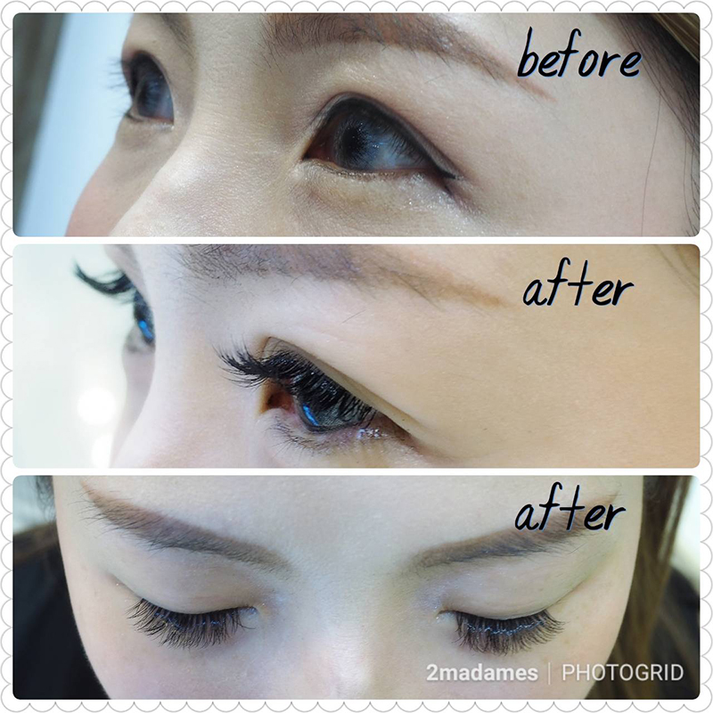 TINGLE,ต่อขนตา,สักคิ้ว 3 มิติ,ต่อขนตาเส้นต่อเส้น,ต่อขนตาวอลลุ่ม,สไลด์คิ้ว,รีวิว,pantip,ราคา,แว๊กซ์คิ้ว,ต่อขนตาธรรมชาติ,tingle lash,EyebrowShaping,ออกแบบคิ้ว,tingle esplanade,tingle gaysorn village,tingle central pinklao,Eyelash Removal,eyelash,eye brow,brow and lash expert,tinglebrow,TINGLE Ultimate Lash,TINGLE LASH Classic