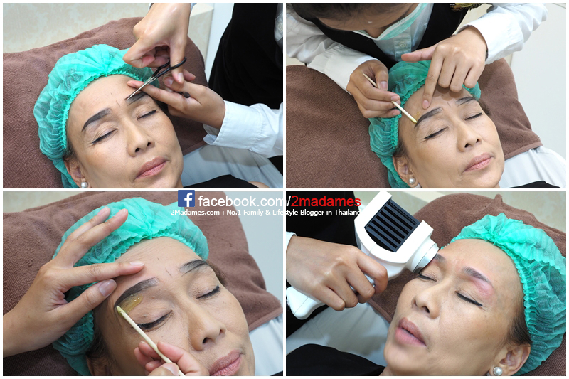 TINGLE,ต่อขนตา,สักคิ้ว 3 มิติ,ต่อขนตาเส้นต่อเส้น,ต่อขนตาวอลลุ่ม,สไลด์คิ้ว,รีวิว,pantip,ราคา,แว๊กซ์คิ้ว,ต่อขนตาธรรมชาติ,tingle lash,EyebrowShaping,ออกแบบคิ้ว,tingle esplanade,tingle gaysorn village,tingle central pinklao,Eyelash Removal,eyelash,eye brow,brow and lash expert,tinglebrow,TINGLE Ultimate Lash,TINGLE LASH Classic